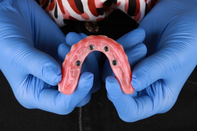 5 dicas de como realizar implantes dentários sem dor