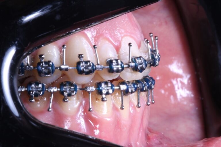 Cirurgia ortognatica rk odontologia